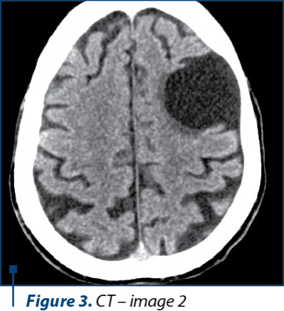 Figure 3. CT – image 2