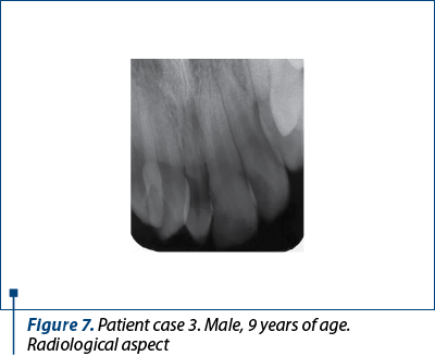 Figure 7. Patient case 3. Male, 9 years of age. Radiological aspect 