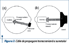 Figura 3. Căile de propagare transcraniană a sunetului
